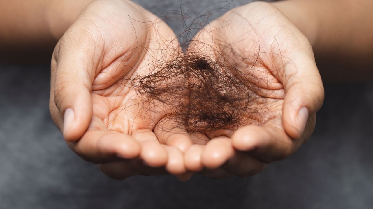 Caduta di capelli da stress: come intervenire per tempo